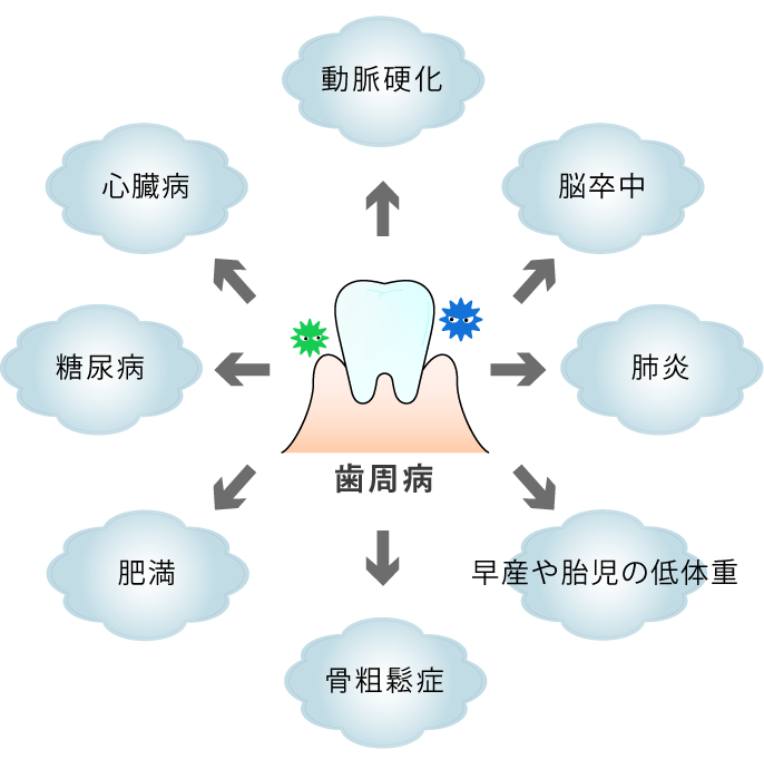 歯を失う1番の原因である歯周病は全身の病気も悪化させます